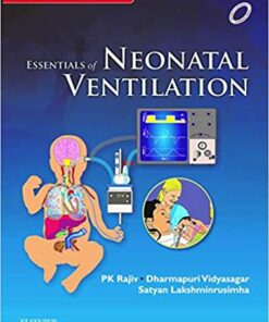 Essentials of Neonatal Ventilation, 1st edition 1st Edition PDF
