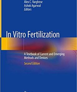 In Vitro Fertilization: A Textbook of Current and Emerging Methods and Devices 2nd ed. 2019 Edition PDF