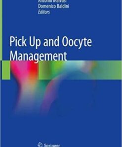 Pick Up and Oocyte Management 1st ed. 2020 Edition PDF