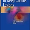 Management of Deep Carious Lesions 1st ed. 2018 Edition PDF