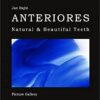 Anteriores: Natural & Beautiful Teeth: Picture Gallery PDF