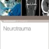 Neurotrauma (Neurosurgery by Example) 1st Edition PDF