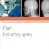 Pain Neurosurgery (Neurosurgery by Example) 1st Edition PDF