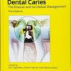 Dental Caries The Disease and Its Clinical Management PDF