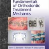 Fundamentals of Orthodontic Treatment Mechanics PDF