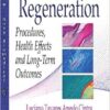 Guided Tissue Regeneration: Procedures, Health Effects and Long-term Outcomes PDF