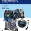 Functional Neurosurgery: The Essentials 1st Edition PDF