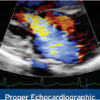 ASE: Proper Echocardiographic Measurements: How & Why 2nd Edition