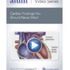 Cardiac Findings You Should Never Miss!