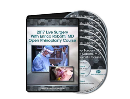 2017 Live Surgery With Enrico Robotti Open Rhinoplasty Course