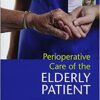 Perioperative Care of the Elderly Patient 1st Edition PDF