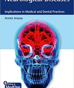 Neurological Diseases: Implications in Medical and Dental Practices 1st Edition PDF