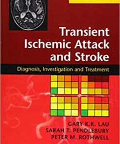 Transient Ischemic Attack and Stroke: Diagnosis, Investigation and Treatment 2nd Edition PDF
