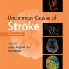 Uncommon Causes of Stroke 3rd Edition PDF