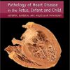 Pathology of Heart Disease in the Fetus, Infant and Child 1st Edition PDF