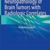 Neuropathology of Brain Tumors with Radiologic Correlates 1st ed. 2020 Edition PDF