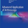 Advanced Application of Arthroscopy: A Practical Guide with Illustrative Cases 1st ed. 2020 Edition PDF