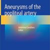 Aneurysms of the Popliteal Artery 1st ed. 2021 Edition PDF