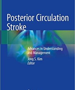 Posterior Circulation Stroke: Advances in Understanding and Management 1st ed. 2021 Edition PDF