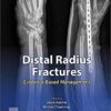 Distal Radius Fractures: Evidence-Based Management 1st Edition PDF