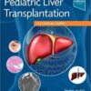Pediatric Liver Transplantation: A Clinical Guide 1st Edition PDF