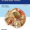 Comprehensive Management of Skull Base Tumors 2nd Edition PDF & VIDEO
