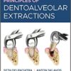 Principles of Dentoalveolar Extractions 1st Edition PDF