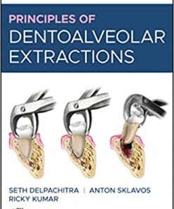 Principles of Dentoalveolar Extractions 1st Edition PDF