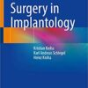 Guided Surgery in Implantology 1st ed. 2021 Edition PDF