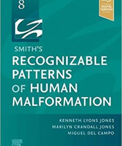 Smith's Recognizable Patterns of Human Malformation 8th Edition PDF