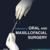 Fundamentals of Oral and Maxillofacial Surgery PDF
