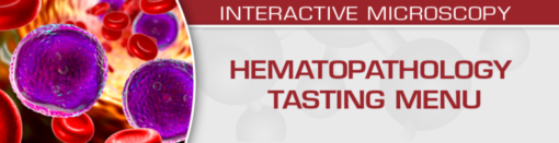 USCAP Hematopathology Tasting Menu: A Sampling of Delightful Diagnostic Challenges 2021 (CME VIDEOS)