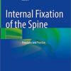 Internal Fixation of the Spine: Principles and Practice 1st ed. 2021 Edition PDF