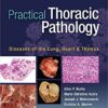 Practical Thoracic Pathology: Diseases of the Lung, Heart, and Thymus First Edition PDF