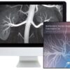 ARRS Multimodality Vascular Imaging: From Head to Toe 2020