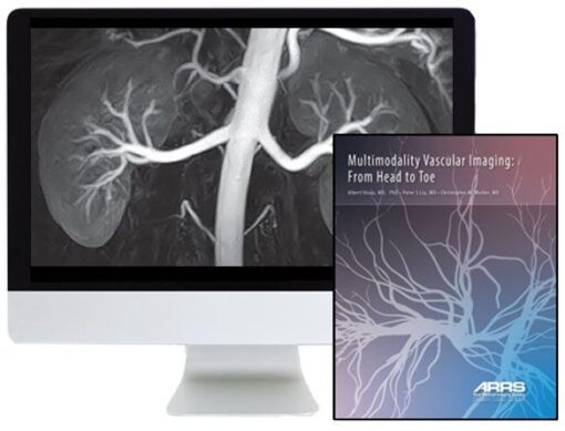 ARRS Multimodality Vascular Imaging: From Head to Toe 2020