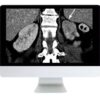 ARRS Abdominal and Thoracic Imaging Guidelines Applied: Evidence Versus Opinion 2021