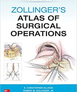 Zollinger's Atlas of Surgical Operations, Tenth Edition PDF & VIDEO