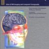 Cranial Neuroimaging and Clinical Neuroanatomy: Atlas of MR Imaging and Computed Tomography PDF