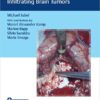 Video Atlas of Neurophysiological Monitoring in Surgery of Infiltrating Brain Tumors 1st Edition PDF
