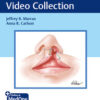 The Duke Cleft Video Collection PDF & VIDEO