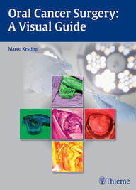 Oral Cancer Surgery: A Visual Guide 1st Edition PDF