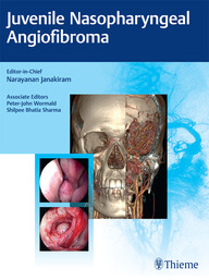 Juvenile Nasopharyngeal Angiofibroma 1st Edition PDF