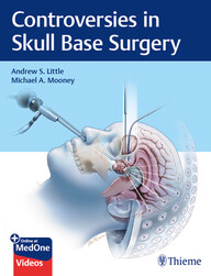 Controversies in Skull Base Surgery 1st Edition PDF & VIDEO