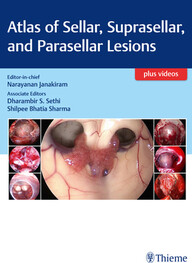 Atlas of Sellar, Suprasellar, and Parasellar Lesions 1st Ed PDF