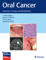 Oral Cancer: Evaluation, Therapy, and Rehabilitation 1st Edition PDF & VIDEO
