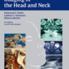 Imaging of the Head and Neck PDF