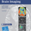 Case-Based Brain Imaging 2nd Edition PDF