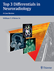 Top 3 Differentials in Neuroradiology 1st Edition PDF