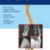 Association of Spine Surgeons of India (ASSI) Monograph Series: Ankylosing Spondylitis PDF